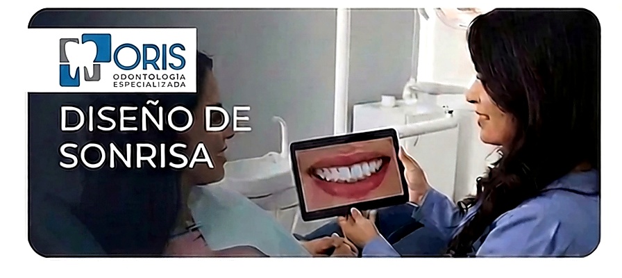 Diseño de sonrisa en ORIS Odontología Quito